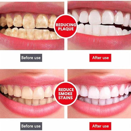 Yayashi SP-4 Ultra Whitening Toothpaste – Probiotic Stain Remover, Fresh Breath & Gum Protection – 120gm