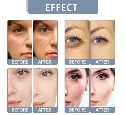 Fort Whitening Glutathione White Plus Serum – Skin Brightening, Anti-Dark Spots & Glowing Face Care