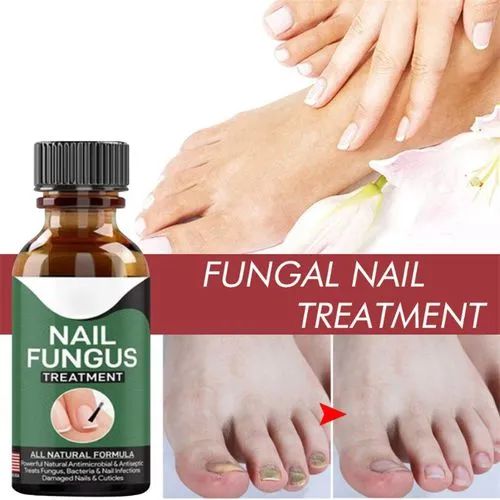 Fast Nail Fungal Treatment Serum – Nail Repair Essence for Fungus Removal & Healthy Nails