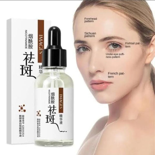 Freckle Removal Face Serum – 30ml Whitening & Hydrating Facial Serum For Dark Spots, Acne Marks, Pigmentation & Moisturizing Skin Care