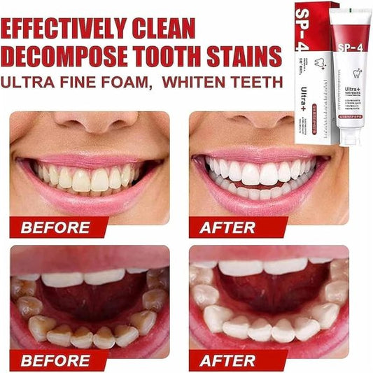 Yayashi SP-4 Ultra Whitening Toothpaste – Probiotic Stain Remover, Fresh Breath & Gum Protection – 120gm